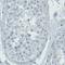 Thy-1 Cell Surface Antigen antibody, NBP2-52960, Novus Biologicals, Immunohistochemistry paraffin image 