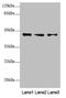 Ring Finger Protein 34 antibody, LS-C676410, Lifespan Biosciences, Western Blot image 