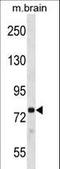 Protein Kinase C Beta antibody, LS-C164547, Lifespan Biosciences, Western Blot image 
