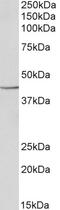 Capping Actin Protein, Gelsolin Like antibody, 43-522, ProSci, Western Blot image 