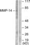 Matrix Metallopeptidase 14 antibody, abx013143, Abbexa, Western Blot image 