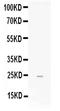 Fibroblast Growth Factor 19 antibody, PB10061, Boster Biological Technology, Western Blot image 