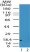 Acid Phosphatase 1 antibody, NB100-56477, Novus Biologicals, Western Blot image 