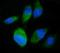 Staphylococcal Nuclease And Tudor Domain Containing 1 antibody, M02602-2, Boster Biological Technology, Immunofluorescence image 