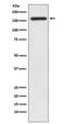 Insulin Receptor Substrate 1 antibody, M00268, Boster Biological Technology, Western Blot image 