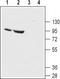 ENaC-Alpha antibody, TA329045, Origene, Western Blot image 