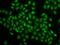 Coilin antibody, GTX55575, GeneTex, Immunocytochemistry image 