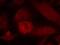 Insulin Receptor Substrate 1 antibody, GTX50551, GeneTex, Immunofluorescence image 