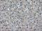 Isocitrate Dehydrogenase (NAD(+)) 3 Alpha antibody, NBP2-02158, Novus Biologicals, Immunohistochemistry paraffin image 