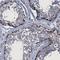 Tubulin Polyglutamylase Complex Subunit 2 antibody, NBP1-85062, Novus Biologicals, Immunohistochemistry frozen image 