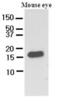 Cellular Retinoic Acid Binding Protein 2 antibody, GTX50029, GeneTex, Western Blot image 