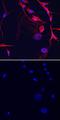 ST6 N-Acetylgalactosaminide Alpha-2,6-Sialyltransferase 5 antibody, MAB67151, R&D Systems, Immunocytochemistry image 