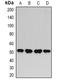 Hyaluronan And Proteoglycan Link Protein 1 antibody, orb378096, Biorbyt, Western Blot image 