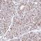 Nei Like DNA Glycosylase 1 antibody, PA5-62913, Invitrogen Antibodies, Immunohistochemistry paraffin image 