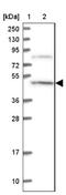 Coiled-Coil Domain Containing 81 antibody, NBP1-91763, Novus Biologicals, Western Blot image 