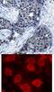 Eukaryotic Translation Initiation Factor 4E antibody, 79-211, ProSci, Immunohistochemistry frozen image 