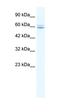 CBFA2/RUNX1 Partner Transcriptional Co-Repressor 3 antibody, orb324506, Biorbyt, Western Blot image 