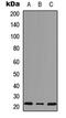 Mitochondrial Ribosomal Protein S18A antibody, abx121523, Abbexa, Western Blot image 