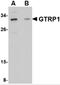 Growth Hormone Regulated TBC Protein 1 antibody, 4591, ProSci Inc, Western Blot image 