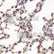 Glycogen Phosphorylase L antibody, A6710, ABclonal Technology, Immunohistochemistry paraffin image 