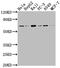 5'-Aminolevulinate Synthase 1 antibody, CSB-RA266893A0HU, Cusabio, Western Blot image 