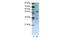 UPF3B Regulator Of Nonsense Mediated MRNA Decay antibody, GTX47258, GeneTex, Western Blot image 