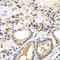 Proteasome Activator Subunit 2 antibody, LS-C334141, Lifespan Biosciences, Immunohistochemistry paraffin image 