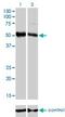 Forkhead Box A2 antibody, H00003170-M01, Novus Biologicals, Western Blot image 