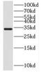 Hydroxysteroid 17-Beta Dehydrogenase 11 antibody, FNab04023, FineTest, Western Blot image 