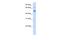 Glutamyl-TRNA Synthetase 2, Mitochondrial antibody, A08567, Boster Biological Technology, Western Blot image 