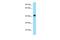 Arylacetamide Deacetylase Like 3 antibody, PA5-70613, Invitrogen Antibodies, Western Blot image 