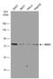 DEAD-Box Helicase 3 Y-Linked antibody, GTX114360, GeneTex, Western Blot image 