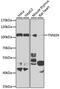 Serine/threonine-protein kinase TNNI3K antibody, GTX55819, GeneTex, Western Blot image 