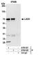Lymphocyte activation gene 3 protein antibody, A700-027, Bethyl Labs, Immunoprecipitation image 