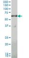 Solute Carrier Family 19 Member 2 antibody, H00010560-M10, Novus Biologicals, Western Blot image 