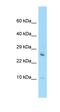 Fas Associated Factor Family Member 2 antibody, orb326419, Biorbyt, Western Blot image 