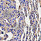 Killer Cell Lectin Like Receptor D1 antibody, A2039, ABclonal Technology, Immunohistochemistry paraffin image 
