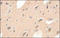ADAM Metallopeptidase With Thrombospondin Type 1 Motif 4 antibody, 251975, Abbiotec, Immunohistochemistry paraffin image 
