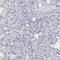 Heme Oxygenase 1 antibody, HPA000635, Atlas Antibodies, Immunohistochemistry frozen image 