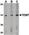 Plexin Domain Containing 1 antibody, PA5-20427, Invitrogen Antibodies, Western Blot image 