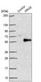 Hemoglobin subunit beta-H1 antibody, PA5-62529, Invitrogen Antibodies, Western Blot image 