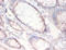 FAS antibody, A50700-100, Epigentek, Immunohistochemistry paraffin image 