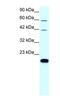 Claudin 23 antibody, NBP1-70500, Novus Biologicals, Western Blot image 