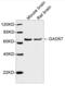 Glutamate Decarboxylase 1 antibody, LS-C203162, Lifespan Biosciences, Western Blot image 