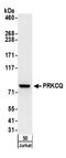 Protein Kinase C Theta antibody, A304-233A, Bethyl Labs, Western Blot image 