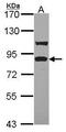Toll Like Receptor Adaptor Molecule 1 antibody, GTX104744, GeneTex, Western Blot image 