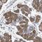 TPD52 Like 1 antibody, PA5-55730, Invitrogen Antibodies, Immunohistochemistry paraffin image 