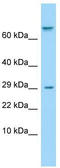 Taste 1 Receptor Member 1 antibody, TA337910, Origene, Western Blot image 