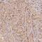 MAPK Activated Protein Kinase 2 antibody, NBP2-57197, Novus Biologicals, Immunohistochemistry frozen image 