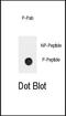 Adrenoceptor Beta 2 antibody, PA5-12977, Invitrogen Antibodies, Dot Blot image 